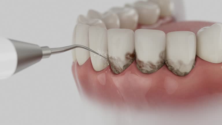 Trusted Root Canal Treatment service in Fenton, MO - Dentist Open Now
